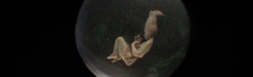 post-thumbnail